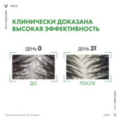 VICHY Шампунь-уход для сухих волос интенсивный Dercos Anti-Dandruff (рефил)